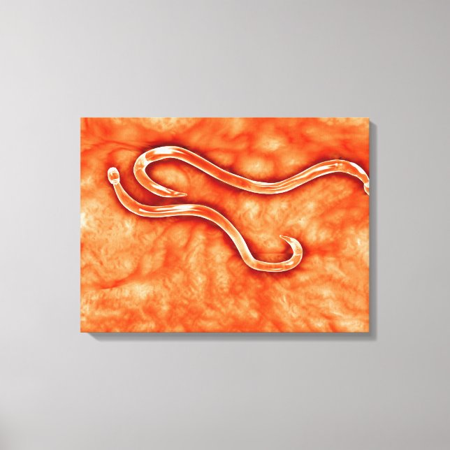 Microscopic View Of Hookworm 2 Canvas Print (Front)