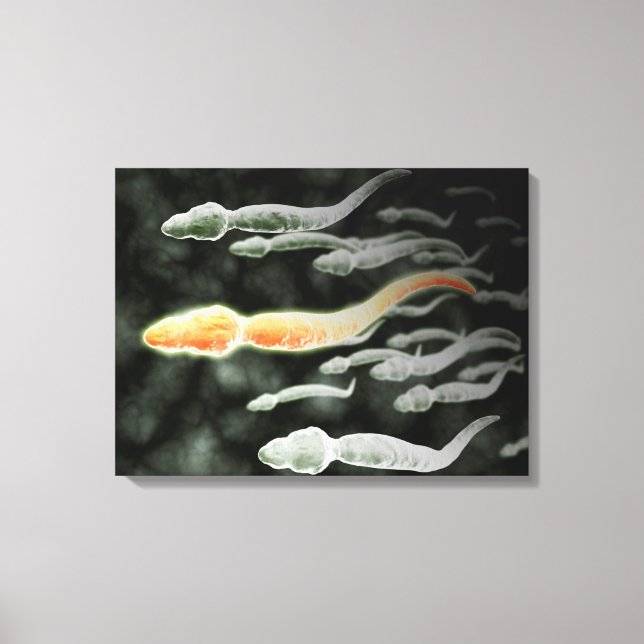 Microscopic View Of Sperm Travelling Canvas Print (Front)