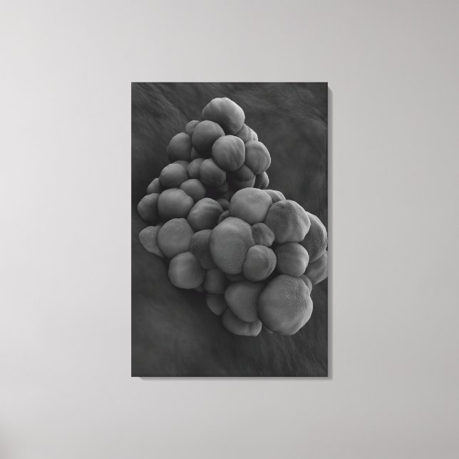Microscopic View Of Tumour 1 Canvas Print (Front)