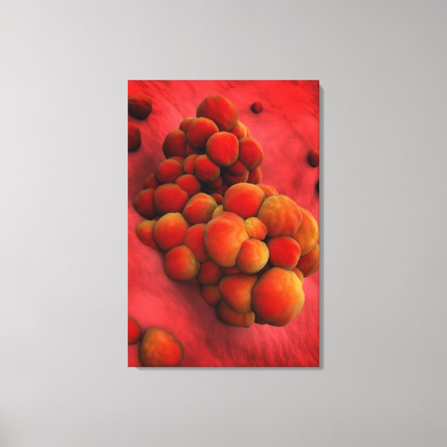 Microscopic View Of Tumour 2 Canvas Print (Front)