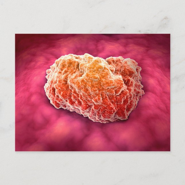 Microscopic View Of Tumour 3 Postcard (Front)