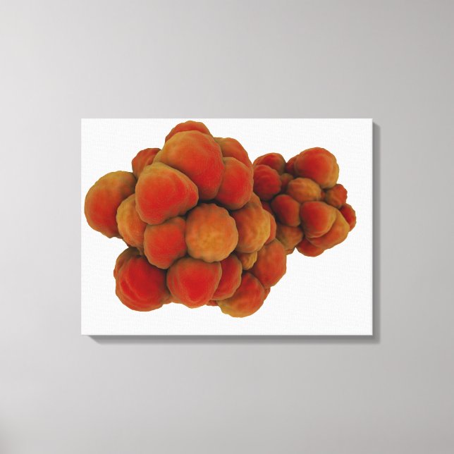 Microscopic View Of Tumour 4 Canvas Print (Front)