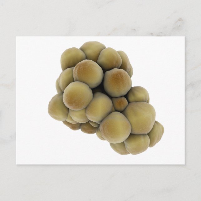 Microscopic View Of Tumour 5 Postcard (Front)