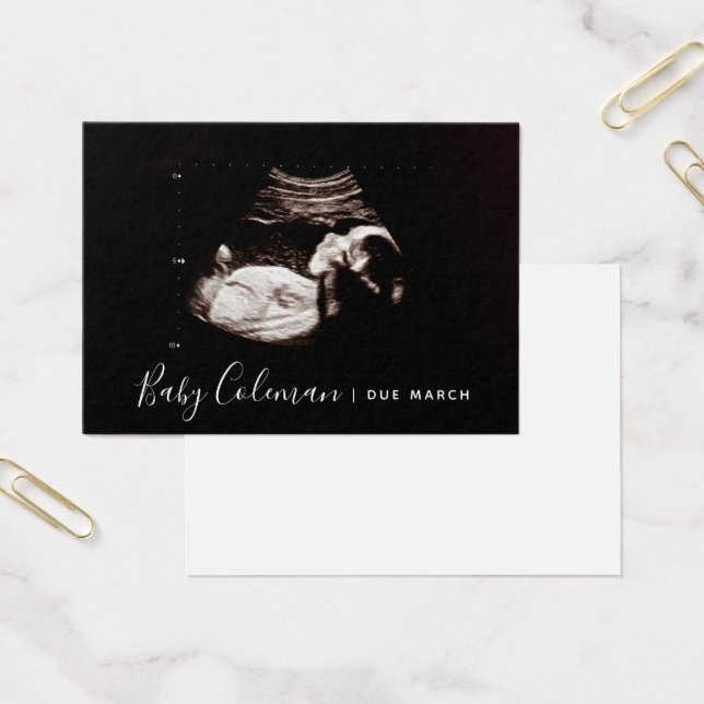 Mini carte Sonogramme Faire-part grossesse (Bureau)