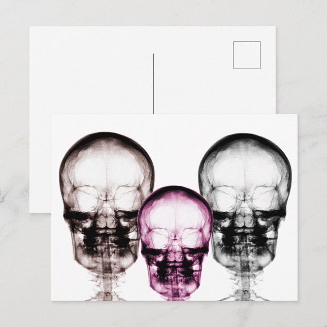 Mixed Colour X-Ray Vision Skeletons Skulls Postcard (Front/Back)