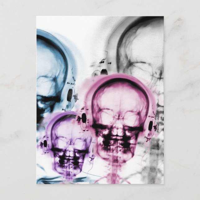 Mixed Colours X-Ray Vision Music Skeleton Skull  Postcard (Front)