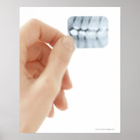 MODEL RELEASED. Dental X-ray.