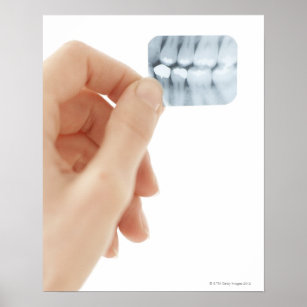 MODEL RELEASED. Dental X-ray. Poster