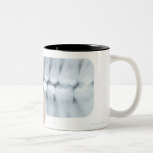 MODEL RELEASED. Dental X-ray. Two-Tone Coffee Mug