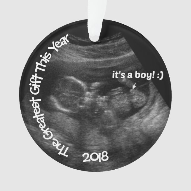 Modèle photo Ultrasound sur mesure (devant)