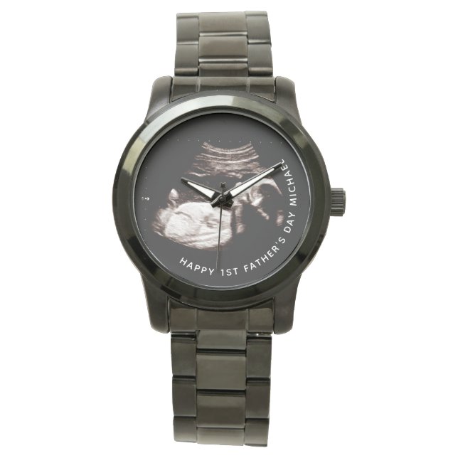 Montre Fête des pères Nom personnalisé Photo Bébé Sonogra (devant)