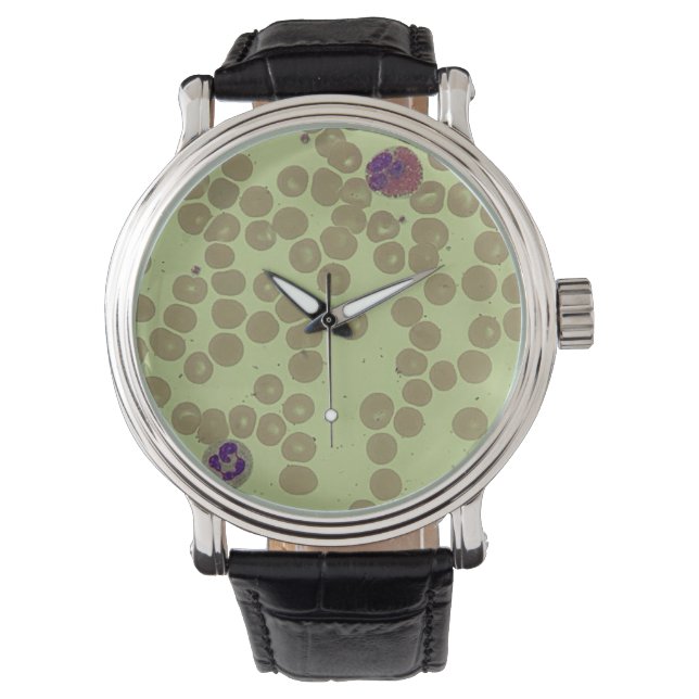 Montre Laboratoire d'hématologie du microscope à diaposit (devant)