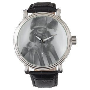 Montre Poignets normaux, rayons X