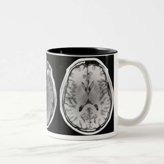 MRI brain image mug (Right)