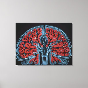 MRI brain scan Canvas Print