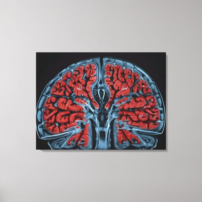 MRI brain scan Canvas Print (Front)