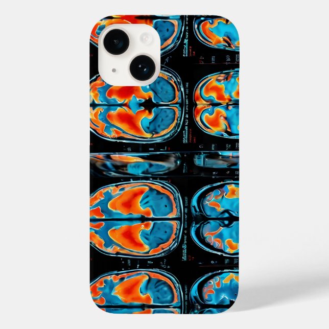 MRI brain scan Case-Mate iPhone Case (Back)