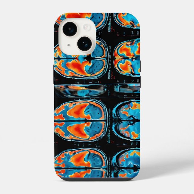MRI brain scan iPhone Case (Back)