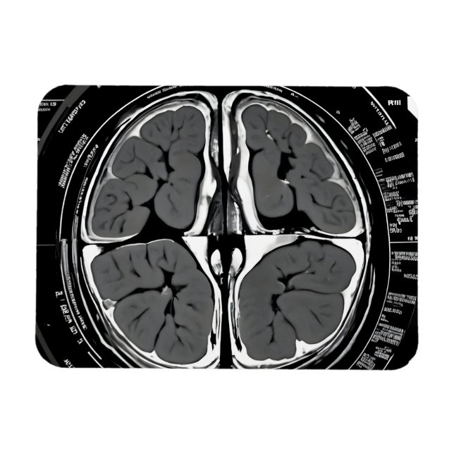 MRI brain scan Magnet (Horizontal)