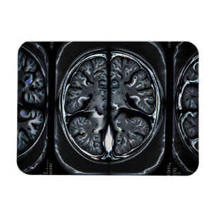 MRI brain scan Magnet