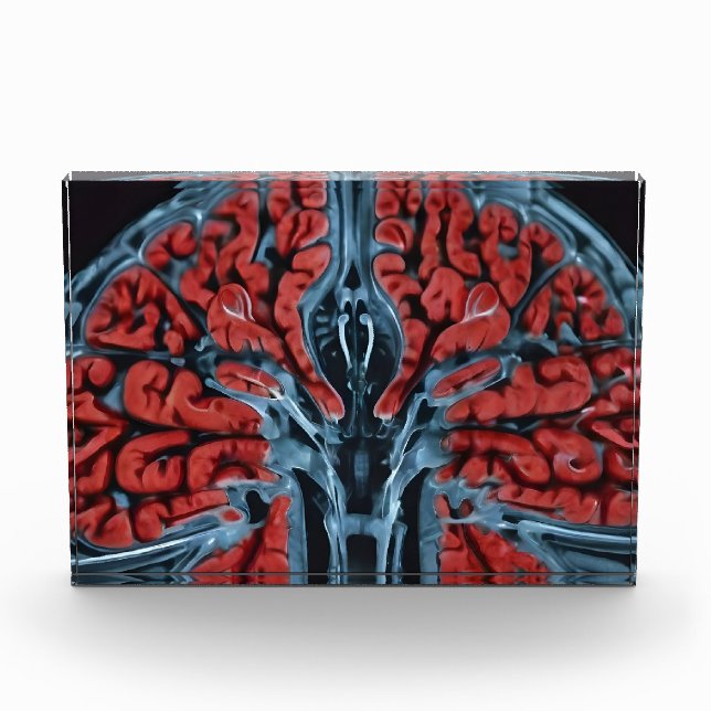 MRI brain scan Photo Block (Front)