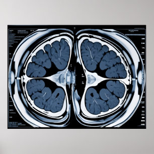 MRI brain scan Poster