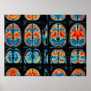 MRI brain scan Poster