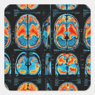 MRI brain scan Square Sticker