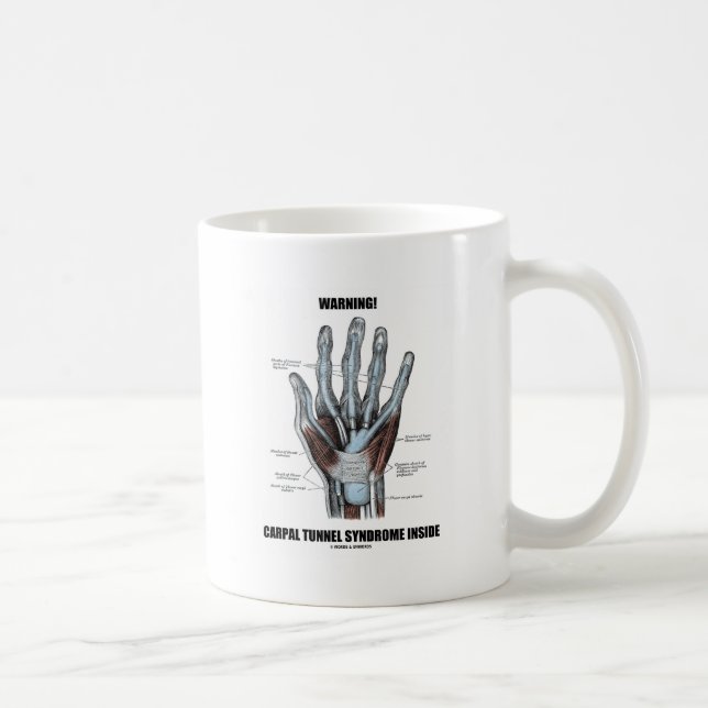 Mug Attention! Syndrome du tunnel carpien à l'intérieu (Droite)