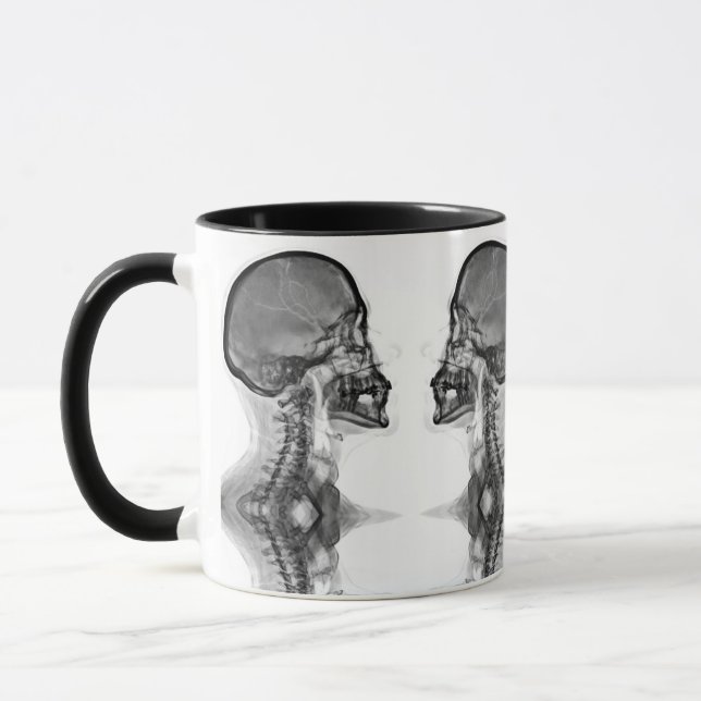 Mug Canette Radiologique (Gauche)