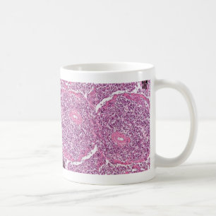 Mug Cellules cancéreuses de Tasse-Poumon de Coffe