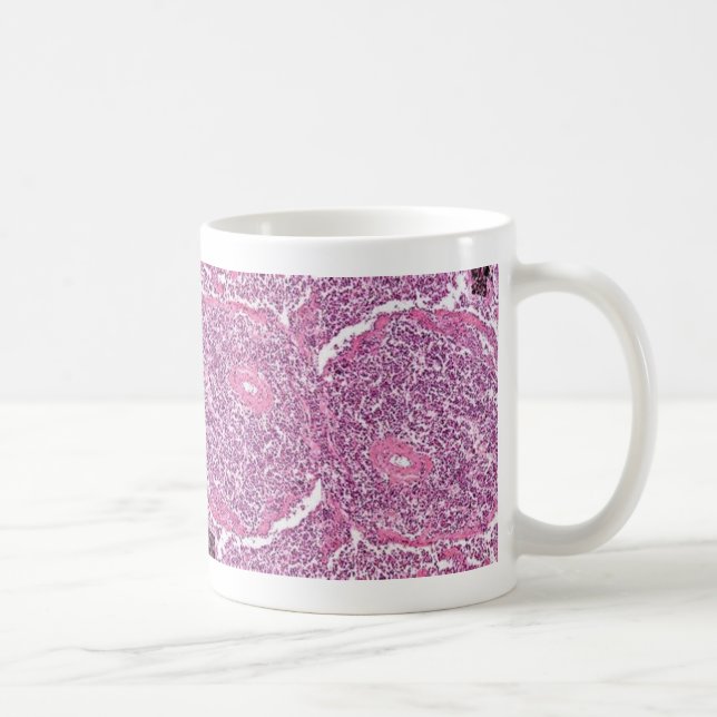 Mug Cellules cancéreuses de Tasse-Poumon de Coffe (Droite)