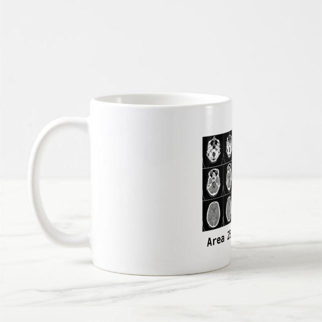 Mug Cerveau : Le secteur 25 m'a incité à le faire (Gauche)