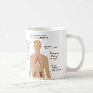 Mug Complications principales de diagramme