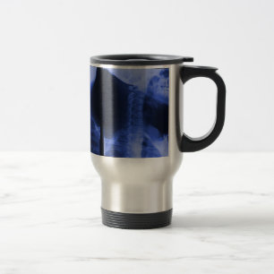 Mug De Voyage 2 radiographiés - Bleu électromagnétique