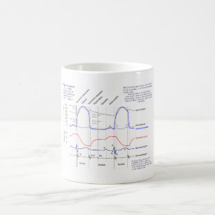 Mug Diagramme de Wiggers
