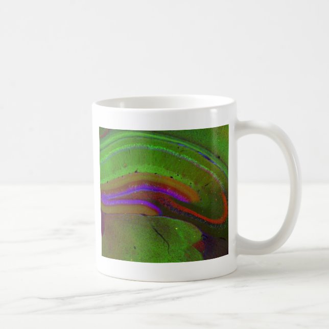 Mug Neurones de Hippocampal (Droite)