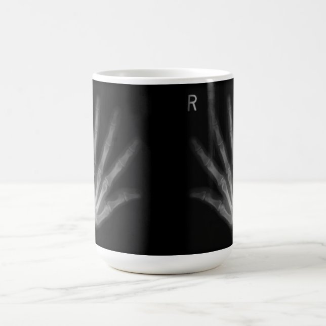 Mug Rayon X numérique supplémentaire, main droite et m (Centre)