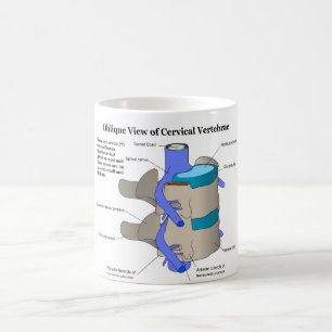 Mug Vertèbre cervicale de la colonne vertébrale