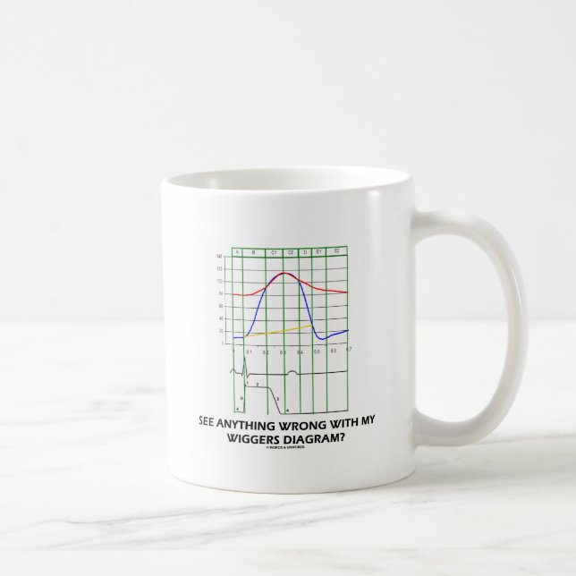 Mug Voyez n'importe quoi mal avec mon diagramme de (Droite)