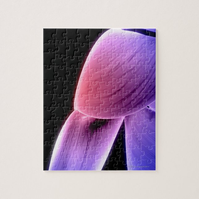 Muscles of the Shoulder 4 Jigsaw Puzzle (Vertical)