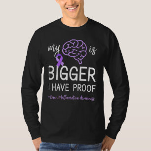 My Brain Is Bigger Have Proof Chiari Malformation T-Shirt