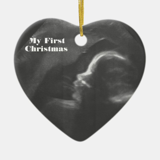 My First Christmas customizable Baby Scan Ceramic Ornament (Front)