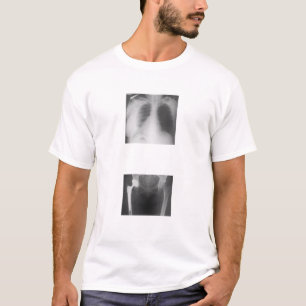 My hip just cracked from sadness. T-Shirt