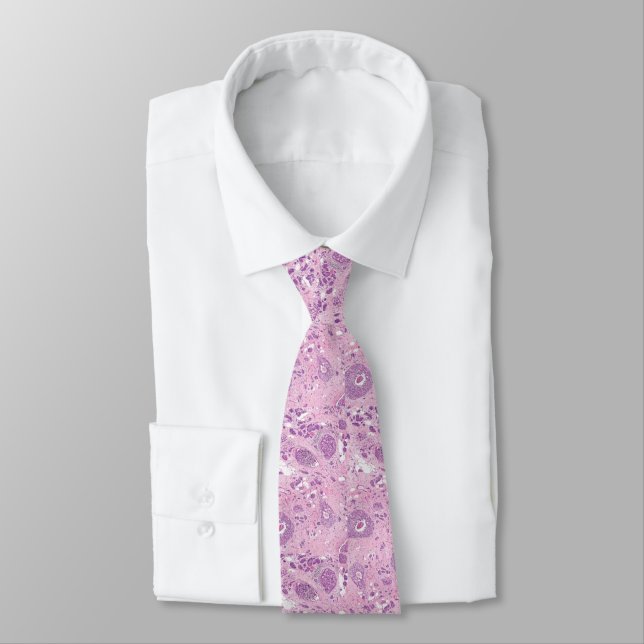Neck Tie - Breast Cancer Cells (Tied)