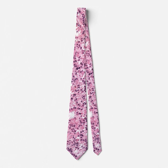 Necktie showing retinal tumour  (Front)