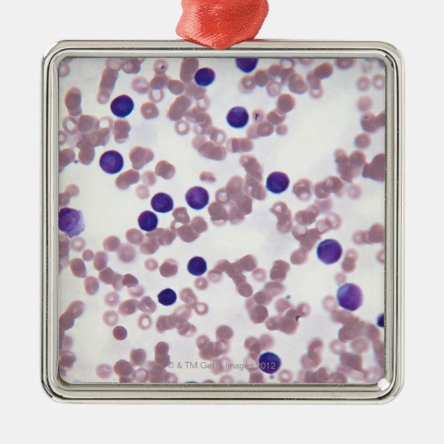 Neoplastic Lymphocyte Cells Metal Ornament (Front)