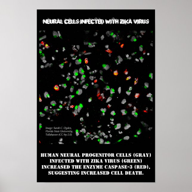 Neural Cells Infected w/ Zika Poster by RoseWrites (Front)