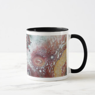 New! Customizable "Malignant Struma Ovarii" Mug