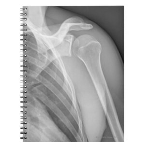 Normal shoulder. X-ray of the healthy left Notebook